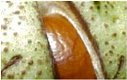 Alpinamed
